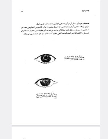 یوگای چشم سوم (اجنا )