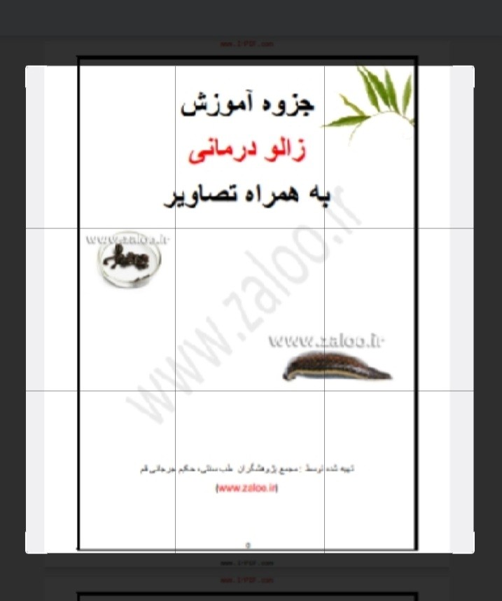 زالو درمانی
